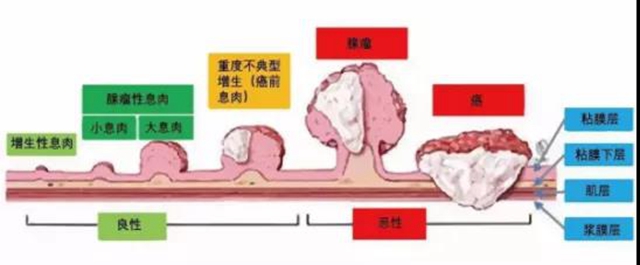人只要活著都會得癌癥嗎？ 談癌色變不如提早預防！(圖3)