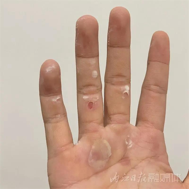 天賦+努力！內(nèi)江24歲女孩九個月“速成”全國冠軍(圖4)