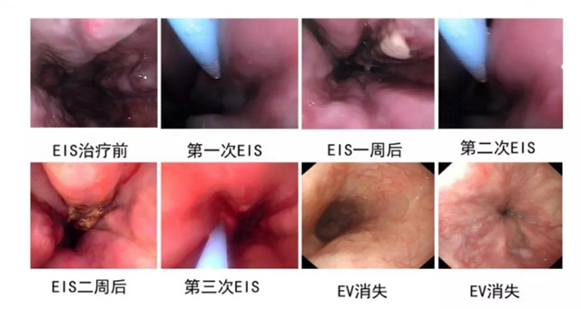 【注意】脾胃·風(fēng)濕免疫病科有新家了！(圖10)